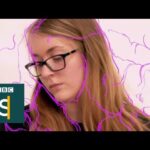 Fibromyalgia Symptoms, Treatment and Real-Life Stories