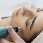 Boost, Brighten, Beautify: Microneedling and Collagen Explained