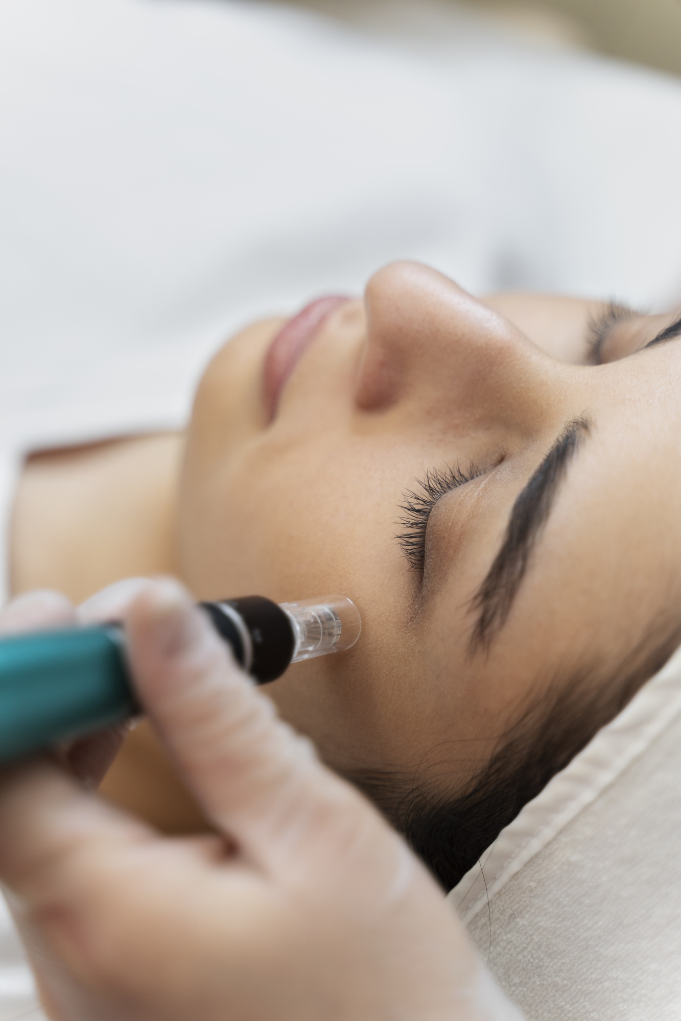 Boost, Brighten, Beautify: Microneedling and Collagen Explained
