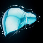 Autoimmune Hepatitis – What to Know About Liver Autoimmunity
