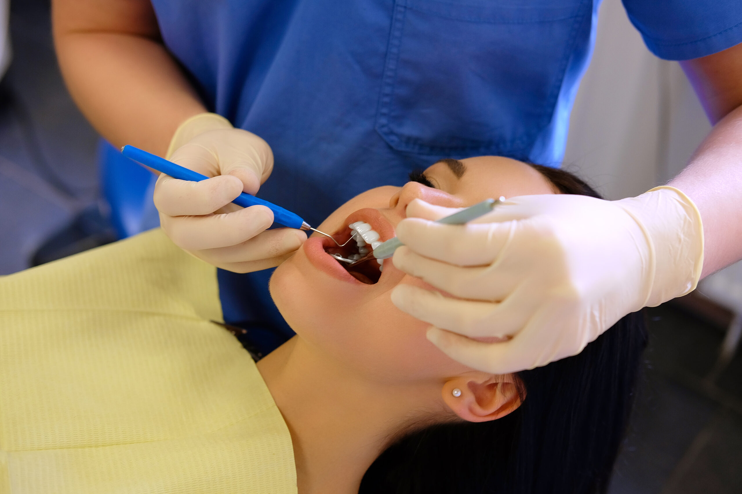Mercury Fillings – Health Risks and Safe Removal