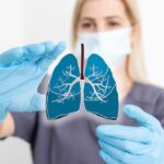 Lung Cancer – Small Cell vs. Non-Small Cell Explained