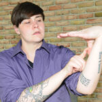 Ehlers-Danlos Syndrome: Understanding Symptoms & Tips