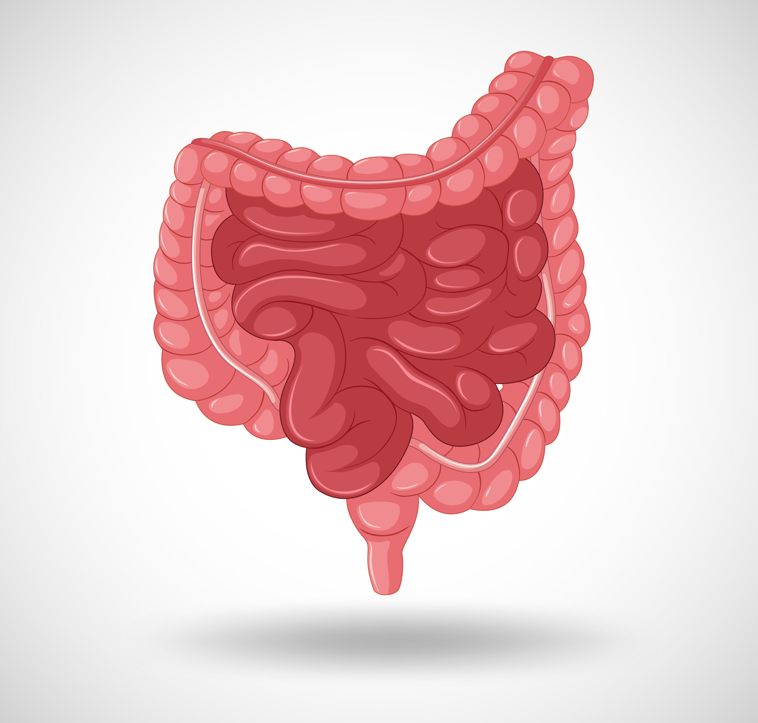 Understanding SIBO: Small Intestinal Bacterial Overgrowth Explained