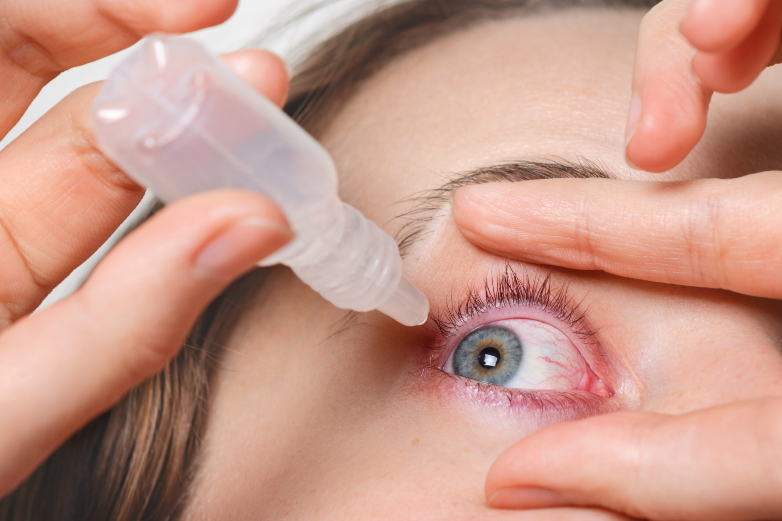 Glaucoma – Pressure Control and Vision Protection